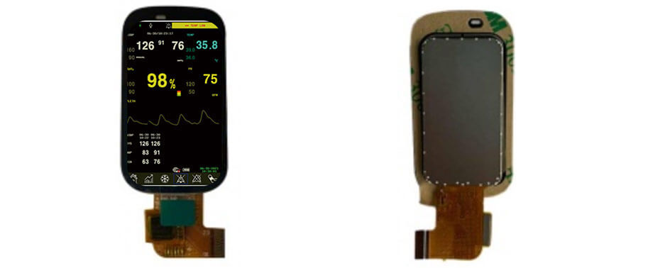 1.45 Inch TFT LCD Display 172×320 CPU LCD Display With Touch For Healthcare & Medical Display Solution