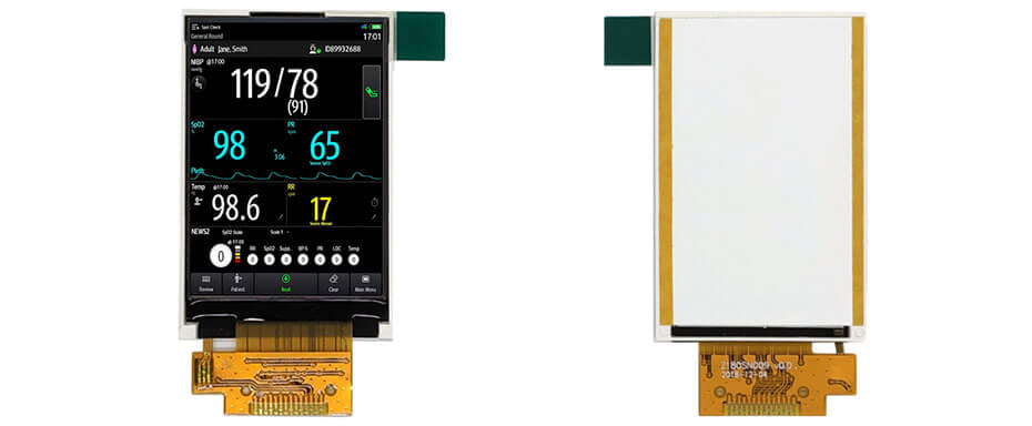 1.77 Inch TFT LCD Display 128×160 SPI LCD Display For Healthcare & Medical Display Solution