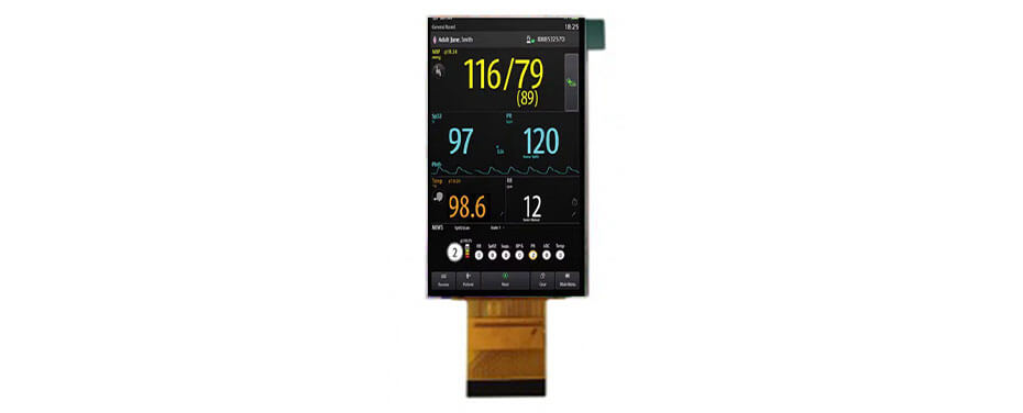 3 Inch TFT LCD Display 480×854 MIPI LCD Display For Healthcare Medical Display Solution
