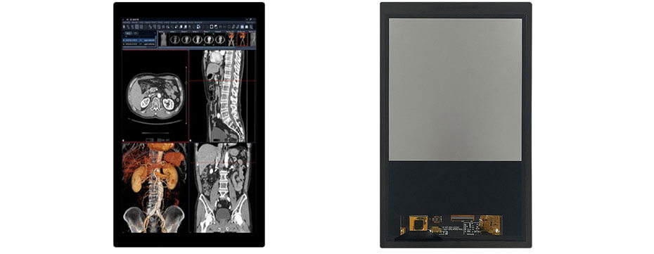 10.1 Inch TFT LCD Display 1200×1920 MIPI High Brightness LCD Display With Capacitive Touch For Healthcare Medical Display Solution