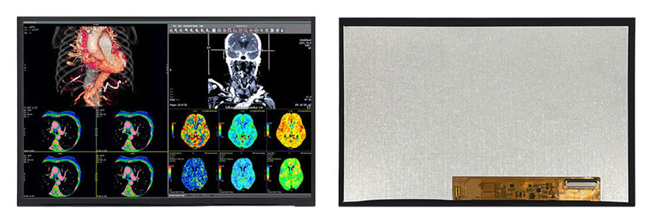 10.1 Inch TFT LCD Display 1280×800 LVDS High Brightness LCD Display For Healthcare Medical Display Solution