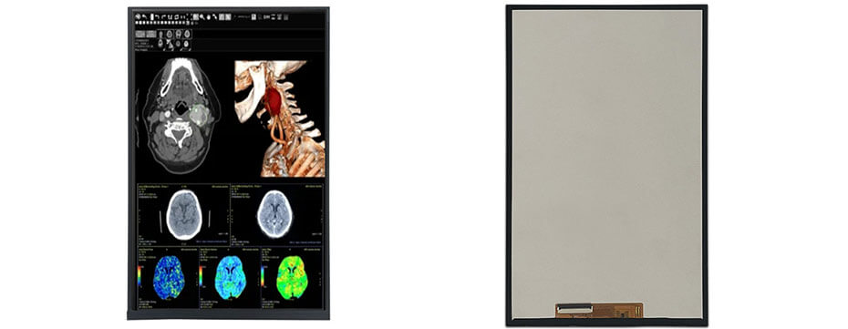 10.1 Inch TFT LCD Display 800×1280 MIPI High Brightness LCD Display For Healthcare Medical Display Solution