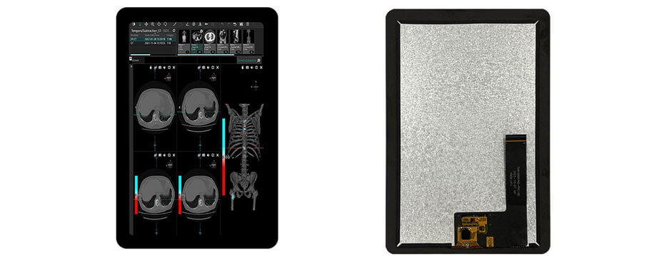 10.1 Inch TFT LCD Display 800×1280 MIPI High Brightness LCD Display With Capacitive Touch For Healthcare Medical Display Solution