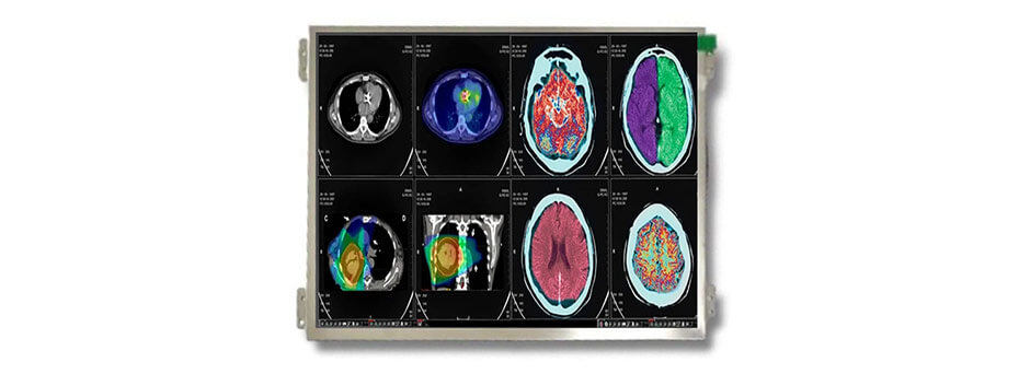 10.4 Inch TFT LCD Display 1024×768 LVDS High Brightness Wide Temperature LCD Display For Healthcare Medical Display Solution