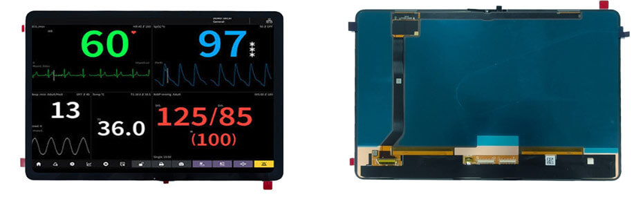 12.6 Inch AMOLED Display 1620×2560 MIPI OLED Display With On-Cell Touch For Healthcare Medical Display Solution