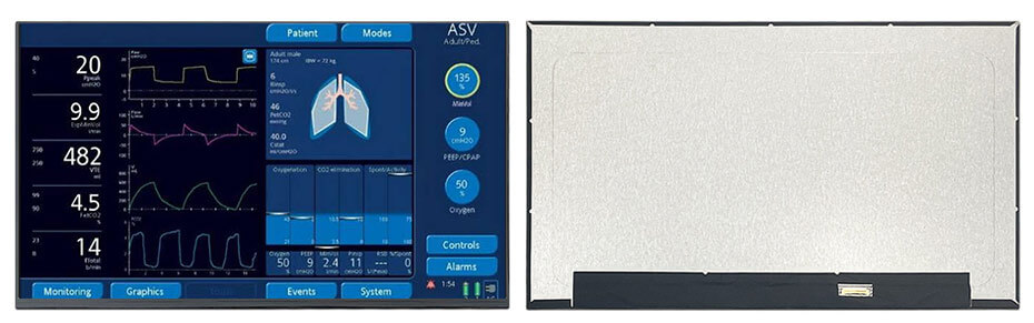 15.6 Inch TFT LCD Display 1920×1080 eDP LCD Display For Healthcare Medical Display Solution