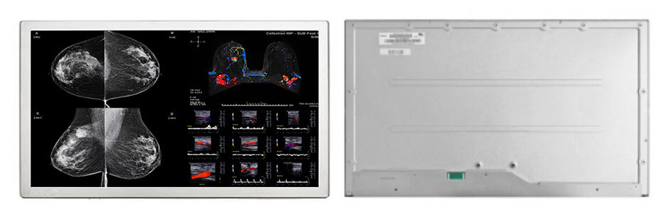 27 Inch TFT LCD Display 1920×1080 LVDS 2000nits High Brightness LCD Display For Healthcare Medical Display Solution ET270FH01-RS_01