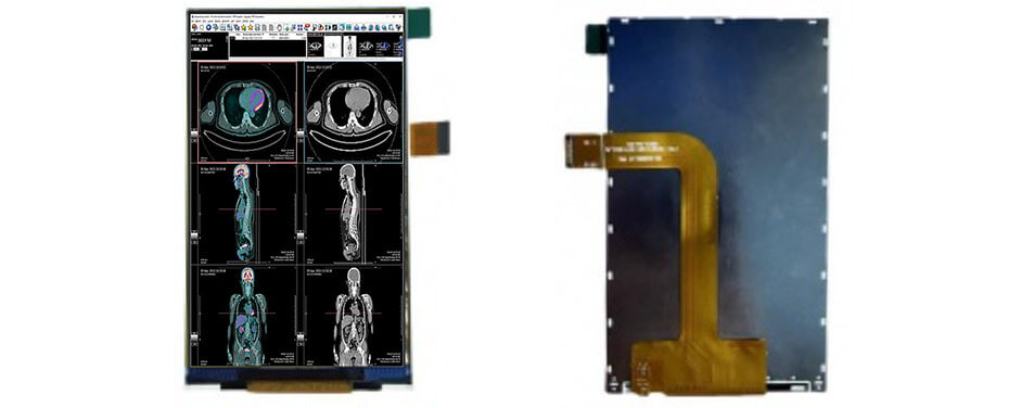 3.97 Inch TFT LCD Display 480×800 MIPI LCD Display For Healthcare Medical Display Solution