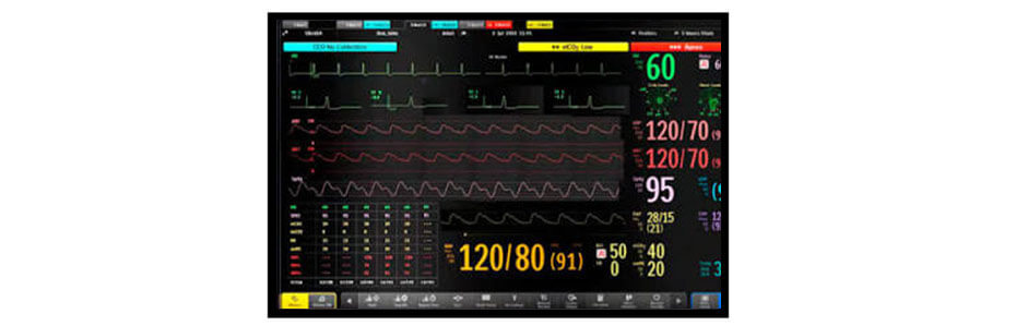 32 Inch TFT LCD Display 3840×2160 LVDS LCD Display For Healthcare Medical Display Solution