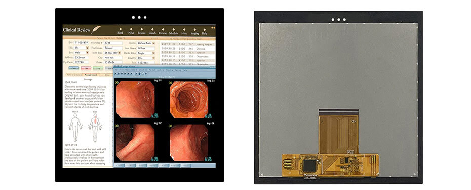 4.2 Inch TFT LCD Display 720×672 MIPI LCD Display With Capacitive Touch For Healthcare Medical Display Solution