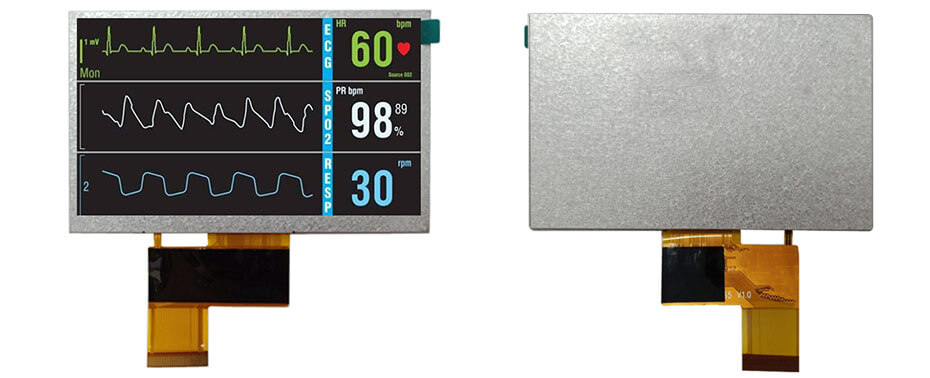 5 Inch TFT LCD Display 480×272 TTL High Brightness LCD Display For Healthcare Medical Display Solution