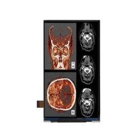 5 Inch TFT LCD Display 720×1280 MIPI LCD Display For Healthcare Medical Display Solution. 