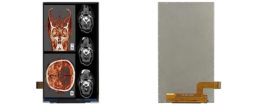 5 Inch TFT LCD Display 720×1280 MIPI LCD Display For Healthcare Medical Display Solution
