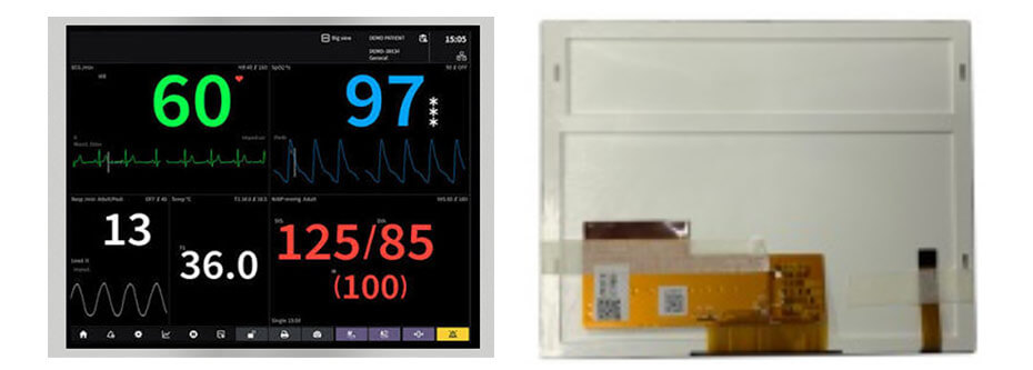 5.7 Inch TFT LCD Display 640×480 CPU RGB SPI LCD Display For Healthcare Medical Display Solution