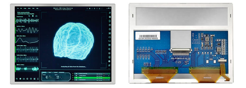 5.7 Inch TFT LCD Display 640×480 TTL 1000nits High Brightness LCD Display For Healthcare Medical Display Solution