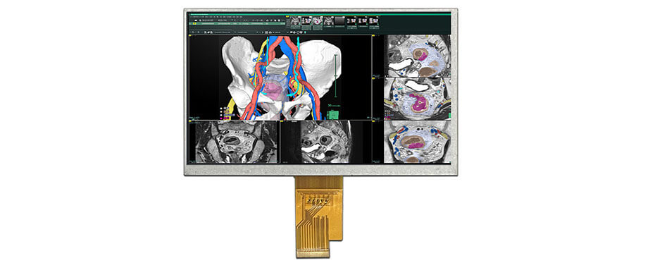 7 Inch TFT LCD Display 1024×600 LVDS High Brightness LCD Display For Healthcare Medical Display Solution