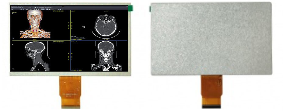 7 Inch TFT LCD Display 1024×600 TTL High Brightness 1000nits LCD Display For Healthcare Medical Display Solution