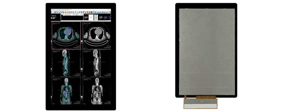 7 Inch TFT LCD Display 1200×1920 MIPI LCD Display With In-Cell Touch For Healthcare Medical Display Solution