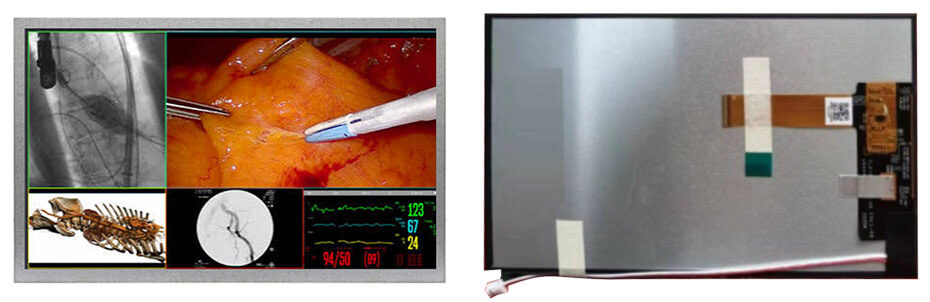 7 Inch TFT LCD Display 1920×1080 MIPI 2000nits High Brightness LCD Display With In-Cell Touch For Healthcare Medical Display Solution