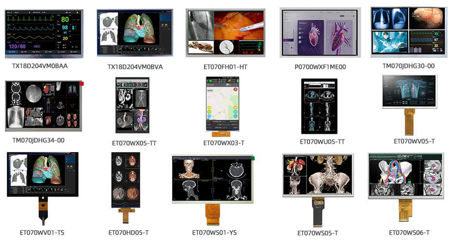 7 Inch TFT LCD Display 1920×1080 MIPI 2000nits High Brightness LCD Display With In-Cell Touch For Healthcare Medical Display Solution