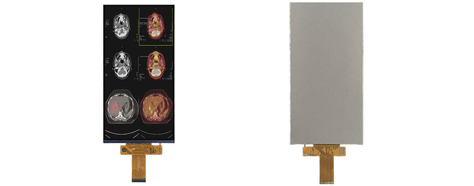 7 Inch TFT LCD Display 720×1440 MIPI LCD Display For Healthcare Medical Display Solution