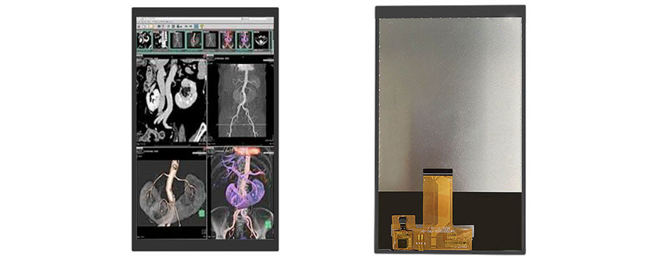 7 Inch TFT LCD Display 800×1280 MIPI High Brightness LCD Display With Capacitive Touch For Healthcare Medical Display Solution