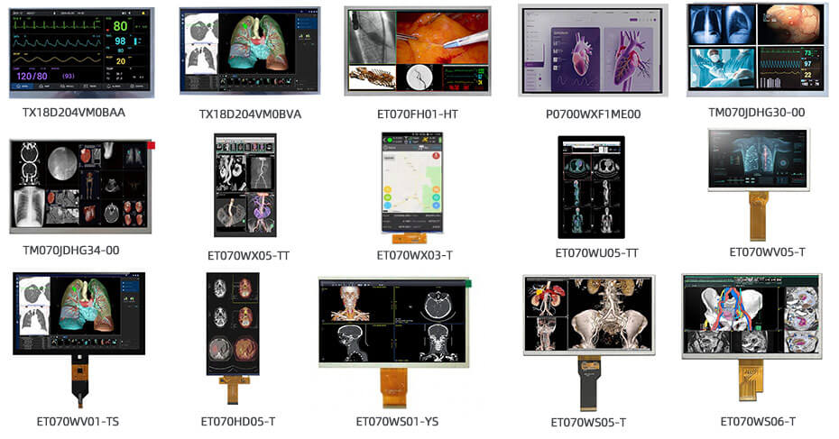 7 Inch TFT LCD Display 800×480 TTL High Brightness LCD Display For Healthcare Medical Display Solution
