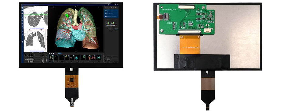 7 Inch TFT LCD Display 800×480 TTL High Brightness LCD Display With Capacitive Touch For Healthcare Medical Display Solution