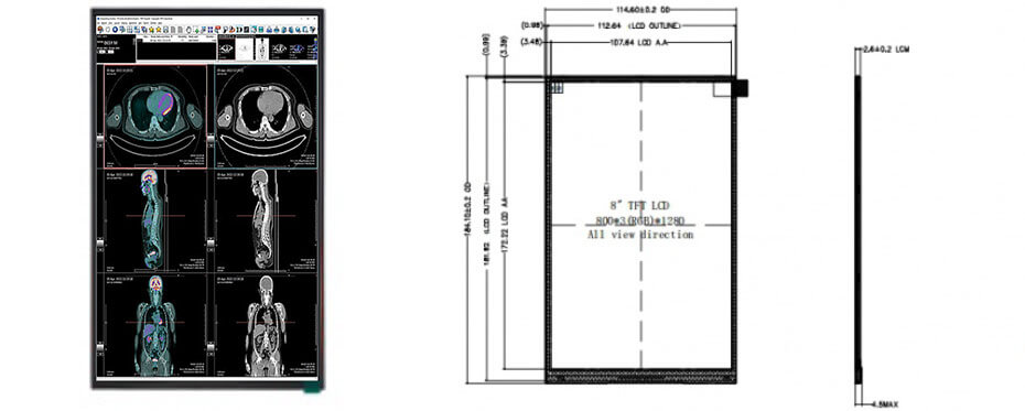 8 Inch TFT LCD Display 800×1280 LVDS LCD Display For Healthcare Medical Display Solution