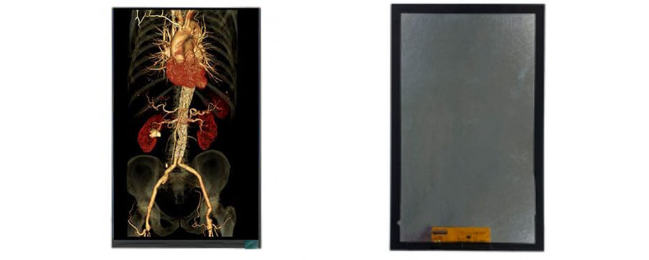 8 Inch TFT LCD Display 800×1280 MIPI LCD Display For Healthcare Medical Display Solution