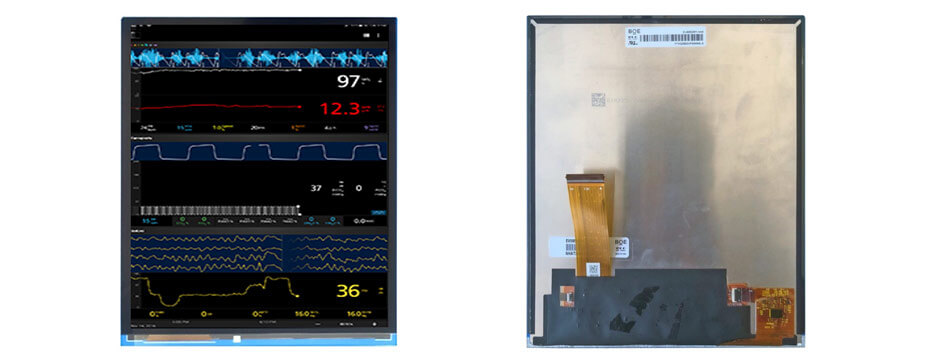 EV095GRM-A40 9.5 Inch TFT LCD Display 1020×1200 LVDS SPI High Brightness LCD Display For Healthcare Medical Display Solution