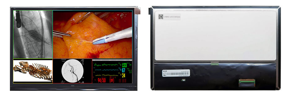EV101WXM-N10 10.1 Inch TFT LCD Display 1280×800 LVDS LCD Display For Healthcare Medical Display Solution