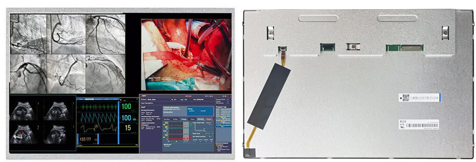 EV121WXM-N12 12.1 Inch TFT LCD Display 1280×800 LVDS High Brightness LCD Display For Healthcare Medical Display Solution