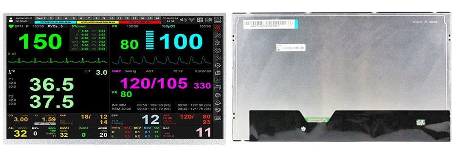 https://www.youritech.com/uploads/2026/09/EV156FHM-N10-15.6-Inch-TFT-LCD-Display-1920%C3%971080-eDP-High-Brightness-LCD-Display-For-Healthcare-Medical-Display-Solution.jpg
