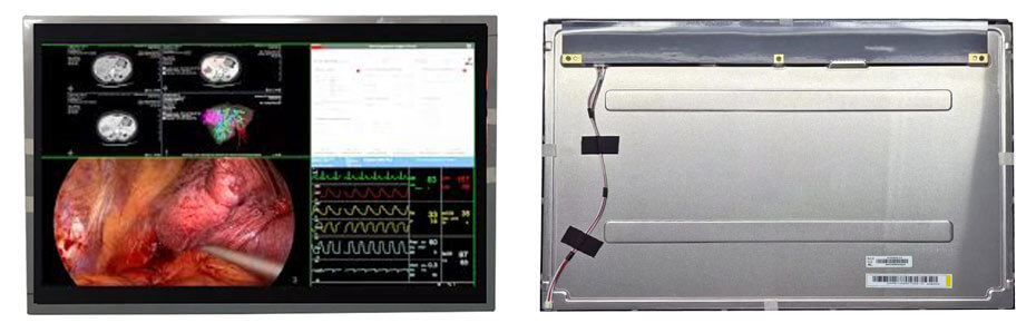 EV220WPM-N10 22 Inch TFT LCD Display 1680×1050 LVDS LCD Display For Healthcare Medical Display Solution