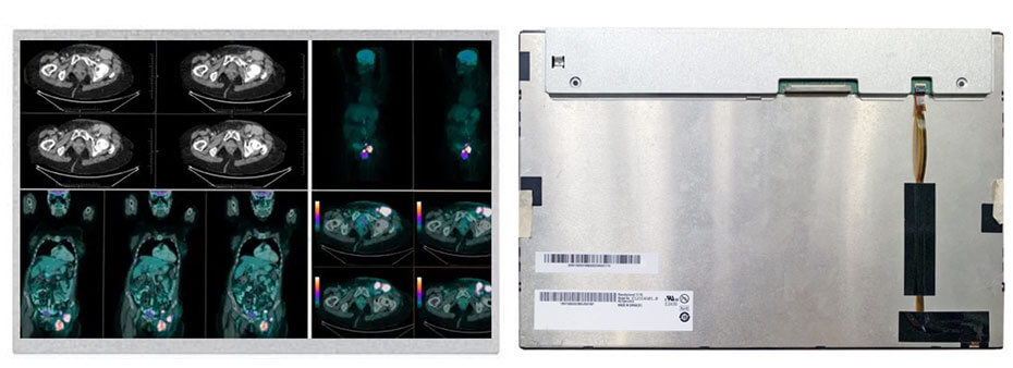G121EAN01.0 12.1 Inch TFT LCD Display 1280×800 LVDS High Brightness Wide Temperature LCD Display For Healthcare Medical Display Solution