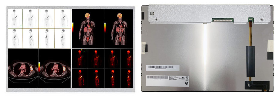 G121EAN01.1 12.1 Inch TFT LCD Display 1280×800 LVDS Wide Temperature LCD Display For Healthcare Medical Display Solution