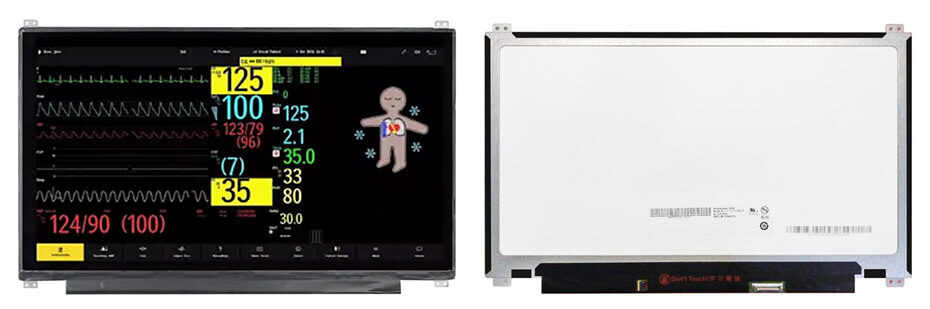 G133HAN02.0 13.3 Inch TFT LCD Display 1920×1080 eDP LCD Display For Healthcare Medical Display Solution