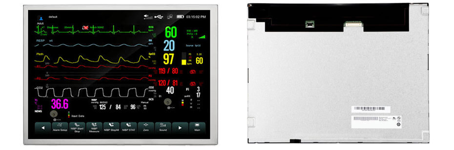 G150XAN02.0 15 Inch TFT LCD Display 1024×768 LVDS High Brightness Wide Temperature LCD Display For Healthcare Medical Display Solution