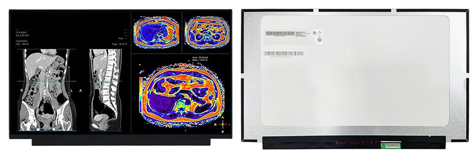 G156HAN03.0 15.6 Inch TFT LCD Display 1920×1080 eDP LCD Display For Healthcare Medical Display Solution