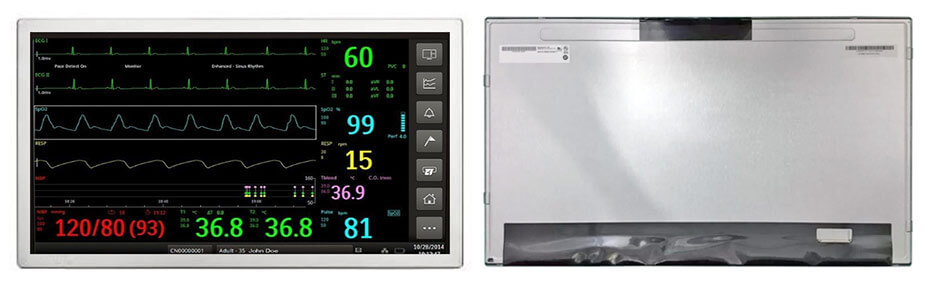 G238HAN01.0 23.8 Inch TFT LCD Display 1920×1080 LVDS LCD Display For Healthcare Medical Display Solution