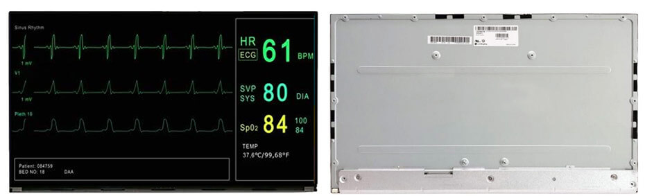 LB238WFM-SSA1 23.8 Inch TFT LCD Display 1920×1080 LVDS LCD Display For Healthcare Medical Display Solution