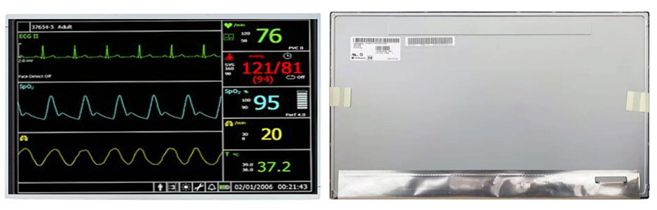 LM215WF3-SLS2 21.5 Inch TFT LCD Display 1920×1080 LVDS LCD Display For Healthcare Medical Display Solution