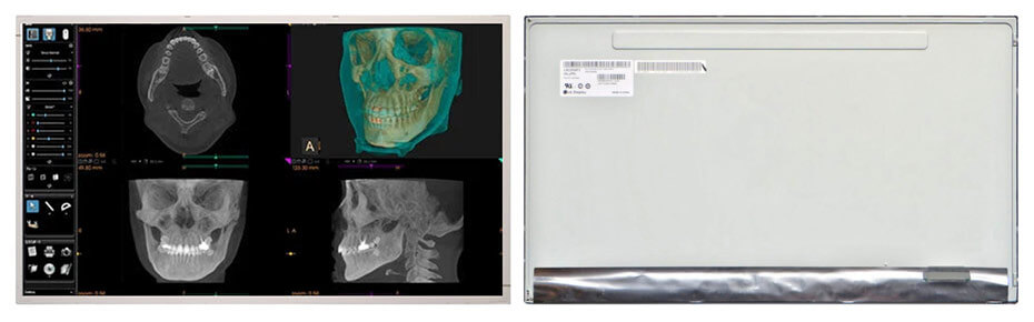 LM230WF3-SLP8 23 Inch TFT LCD Display 1920×1080 LVDS LCD Display For Healthcare Medical Display Solution