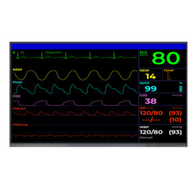 LM238WF8-SSA1 23.8 Inch TFT LCD Display 1920×1080 LVDS LCD Display For Healthcare Medical Display Solution. 