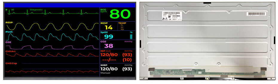 LM238WF8-SSA1 23.8 Inch TFT LCD Display 1920×1080 LVDS LCD Display For Healthcare Medical Display Solution