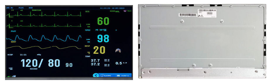 LM238WF8-SSB1 23.8 Inch TFT LCD Display 1920×1080 LVDS LCD Display For Healthcare Medical Display Solution