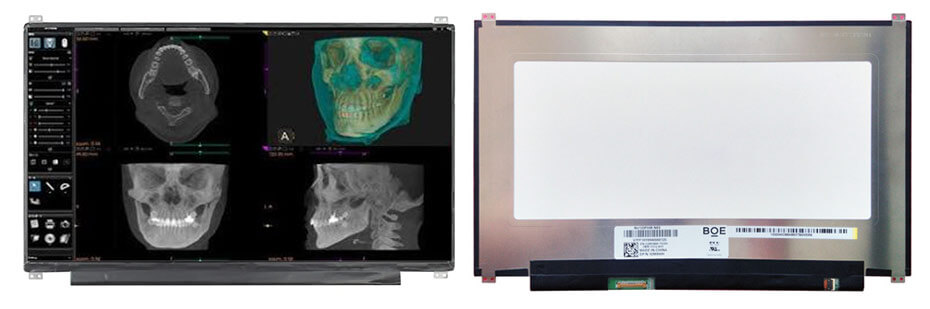 NV133FHM-N63 13.3 Inch TFT LCD Display 1920×1080 eDP LCD Display For Healthcare Medical Display Solution
