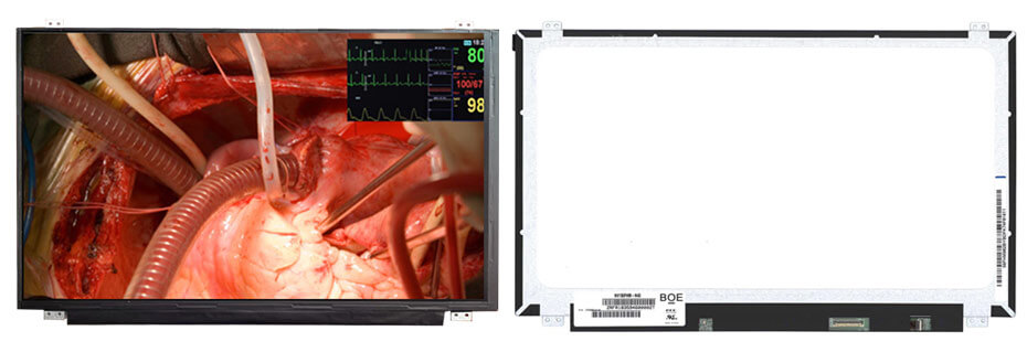 NV156FHM-N43 15.6 Inch TFT LCD Display 1920×1080 eDP LCD Display For Healthcare Medical Display Solution