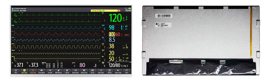 P1560FHF2MA00 15.6 Inch TFT LCD Display 1920×1080 LVDS High Brightness Wide Temperature LCD Display For Healthcare Medical Display Solution